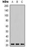 Peroxiredoxin 1 antibody, LS-B14792, Lifespan Biosciences, Western Blot image 