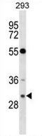 RASD Family Member 2 antibody, AP53587PU-N, Origene, Western Blot image 