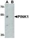 Serine/threonine-protein kinase PINK1, mitochondrial antibody, LS-B12148, Lifespan Biosciences, Western Blot image 