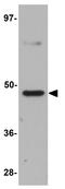 Transmembrane Protein 184C antibody, GTX85192, GeneTex, Western Blot image 