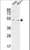 HAUS Augmin Like Complex Subunit 4 antibody, LS-C166795, Lifespan Biosciences, Western Blot image 