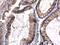 Fms Related Tyrosine Kinase 3 antibody, LS-C311520, Lifespan Biosciences, Immunohistochemistry frozen image 