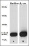 Aconitase antibody, 60-502, ProSci, Immunohistochemistry paraffin image 