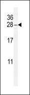 ADP Ribosylation Factor Like GTPase 5B antibody, 55-780, ProSci, Western Blot image 