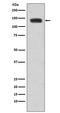 Cadherin 2 antibody, M01577-1, Boster Biological Technology, Western Blot image 