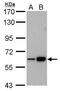 Cystathionine-Beta-Synthase antibody, MA5-17273, Invitrogen Antibodies, Western Blot image 