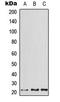 Activating Transcription Factor 3 antibody, LS-C353905, Lifespan Biosciences, Western Blot image 