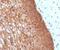 Keratin 14 antibody, 33-959, ProSci, Immunohistochemistry paraffin image 