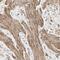 Dihydropyrimidinase Like 3 antibody, NBP1-85447, Novus Biologicals, Immunohistochemistry paraffin image 