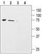 Amiloride-sensitive cation channel 4 antibody, TA329038, Origene, Western Blot image 