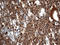 Cystatin B antibody, LS-C796508, Lifespan Biosciences, Immunohistochemistry paraffin image 