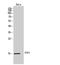 Nuclear Transport Factor 2 antibody, A09424, Boster Biological Technology, Western Blot image 