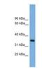 Serine Protease 3 antibody, NBP1-57036, Novus Biologicals, Western Blot image 