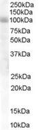 HPS6 Biogenesis Of Lysosomal Organelles Complex 2 Subunit 3 antibody, MBS421162, MyBioSource, Western Blot image 