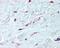 Platelet Derived Growth Factor Receptor Alpha antibody, 49-775, ProSci, Immunohistochemistry paraffin image 