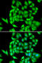 NIMA Related Kinase 3 antibody, STJ28748, St John