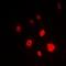 Katanin Regulatory Subunit B1 antibody, orb78111, Biorbyt, Immunofluorescence image 