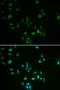 Zinc Finger And BTB Domain Containing 7B antibody, orb324428, Biorbyt, Immunocytochemistry image 