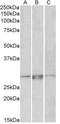 Paired Related Homeobox 1 antibody, AP32718PU-N, Origene, Western Blot image 