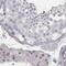 Small Integral Membrane Protein 24 antibody, NBP2-58735, Novus Biologicals, Immunohistochemistry paraffin image 