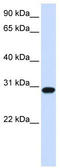 Forkhead Box R1 antibody, TA342510, Origene, Western Blot image 