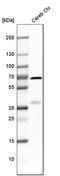Synaptotagmin 1 antibody, HPA008394, Atlas Antibodies, Western Blot image 