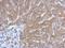 Solute Carrier Family 27 Member 2 antibody, GTX115526, GeneTex, Immunohistochemistry paraffin image 