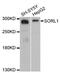 LDLR relative with 11 ligand-binding repeats antibody, A13047, ABclonal Technology, Western Blot image 