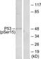 p53 antibody, TA326166, Origene, Western Blot image 