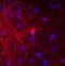 Neurofilament Medium antibody, GTX82642, GeneTex, Immunofluorescence image 