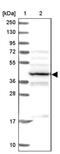 Proteasome 26S Subunit, ATPase 6 antibody, PA5-60140, Invitrogen Antibodies, Western Blot image 