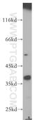 Cylicin 2 antibody, 18729-1-AP, Proteintech Group, Western Blot image 