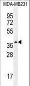 Serine Protease 3 antibody, LS-C162196, Lifespan Biosciences, Western Blot image 