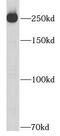 Fibronectin 1 antibody, FNab03123, FineTest, Western Blot image 