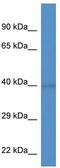WD Repeat Domain 92 antibody, TA340298, Origene, Western Blot image 