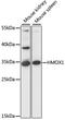 Heme Oxygenase 1 antibody, A1346, ABclonal Technology, Western Blot image 