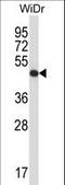 Ubiquinol-Cytochrome C Reductase Core Protein 2 antibody, LS-B9780, Lifespan Biosciences, Western Blot image 