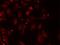 Propionyl-CoA Carboxylase Subunit Beta antibody, GTX33390, GeneTex, Immunofluorescence image 