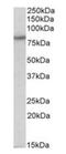 Hyperpolarization Activated Cyclic Nucleotide Gated Potassium Channel 3 antibody, orb125024, Biorbyt, Western Blot image 