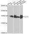 Clathrin Heavy Chain antibody, A7886, ABclonal Technology, Western Blot image 