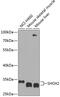 Short Stature Homeobox 2 antibody, 23-501, ProSci, Western Blot image 