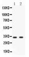 Baculoviral IAP Repeat Containing 7 antibody, RP1081, Boster Biological Technology, Western Blot image 