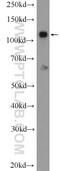 Zinc Finger CCCH-Type Containing 7B antibody, 25624-1-AP, Proteintech Group, Western Blot image 