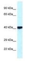 cAMP-dependent protein kinase catalytic subunit beta antibody, NBP1-55008, Novus Biologicals, Western Blot image 