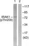 Interleukin 1 Receptor Associated Kinase 1 antibody, TA314091, Origene, Western Blot image 