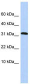 Protein Phosphatase 1 Regulatory Subunit 27 antibody, TA339947, Origene, Western Blot image 