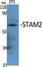 Signal Transducing Adaptor Molecule 2 antibody, A06533-1, Boster Biological Technology, Western Blot image 