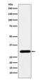 General Transcription Factor IIF Subunit 2 antibody, M10896, Boster Biological Technology, Western Blot image 