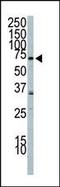 Phosphoinositide-3-Kinase Regulatory Subunit 2 antibody, PA5-15262, Invitrogen Antibodies, Western Blot image 