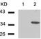 Cyclin Dependent Kinase 6 antibody, TA323940, Origene, Western Blot image 